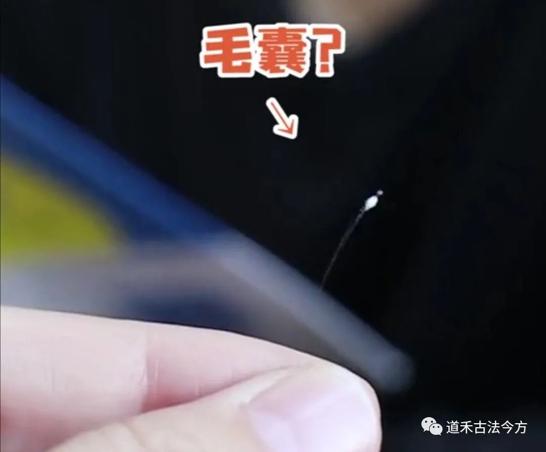 發(fā)根的小白點(diǎn)是毛囊掉了嗎？這些頭發(fā)信號(hào)要警惕！