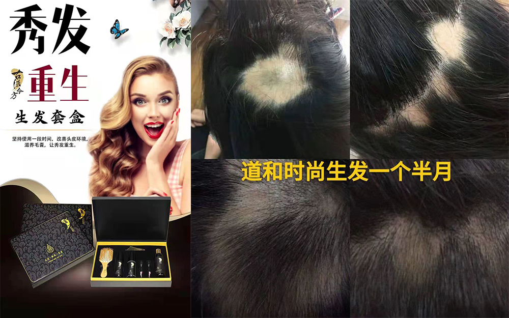 道禾生發(fā)一個月效果