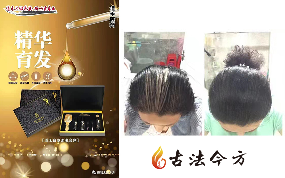 道禾生發(fā)養(yǎng)發(fā)秘方