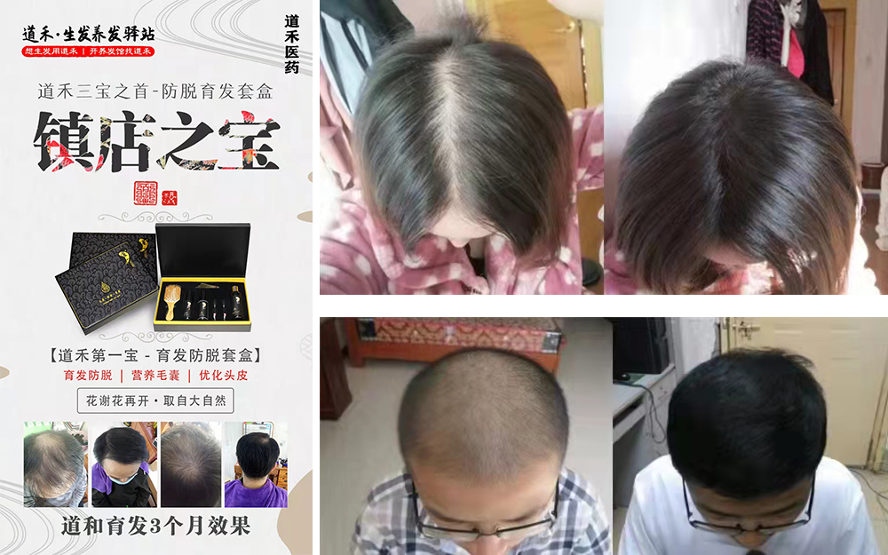 道禾育發(fā)再生發(fā)